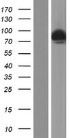 DCLRE1C / Artemis Protein - Western validation with an anti-DDK antibody * L: Control HEK293 lysate R: Over-expression lysate