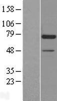DCLRE1C / Artemis Protein - Western validation with an anti-DDK antibody * L: Control HEK293 lysate R: Over-expression lysate