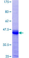 DCLRE1C / Artemis Protein - 12.5% SDS-PAGE Stained with Coomassie Blue.
