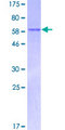 DCN / Decorin Protein - 12.5% SDS-PAGE of human DCN stained with Coomassie Blue