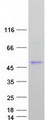 DCN / Decorin Protein - Purified recombinant protein DCN was analyzed by SDS-PAGE gel and Coomassie Blue Staining