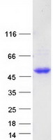 DCN / Decorin Protein - Purified recombinant protein DCN was analyzed by SDS-PAGE gel and Coomassie Blue Staining