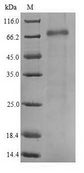DCP1B Protein - (Tris-Glycine gel) Discontinuous SDS-PAGE (reduced) with 5% enrichment gel and 15% separation gel.