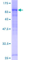 DCP1B Protein - 12.5% SDS-PAGE of human DCP1B stained with Coomassie Blue