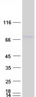 DCP1B Protein - Purified recombinant protein DCP1B was analyzed by SDS-PAGE gel and Coomassie Blue Staining