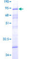 DCP2 Protein - 12.5% SDS-PAGE of human DCP2 stained with Coomassie Blue