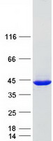 DCPS Protein - Purified recombinant protein DCPS was analyzed by SDS-PAGE gel and Coomassie Blue Staining