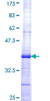 DCST1 Protein - 12.5% SDS-PAGE Stained with Coomassie Blue.