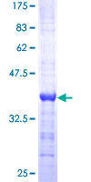 DCT / Dopachrome Tautomerase Protein - 12.5% SDS-PAGE Stained with Coomassie Blue.