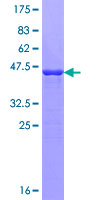 DCTD / dCMP Deaminase Protein - 12.5% SDS-PAGE of human DCTD stained with Coomassie Blue