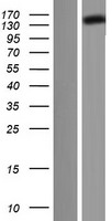 DCTN1 / Dynactin 1 Protein - Western validation with an anti-DDK antibody * L: Control HEK293 lysate R: Over-expression lysate