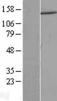 DCTN1 / Dynactin 1 Protein - Western validation with an anti-DDK antibody * L: Control HEK293 lysate R: Over-expression lysate