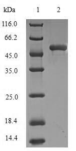 DCTN1 / Dynactin 1 Protein - (Tris-Glycine gel) Discontinuous SDS-PAGE (reduced) with 5% enrichment gel and 15% separation gel.