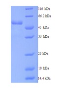 DCTN4 / Dynactin 4 Protein