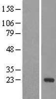 DCTN5 / Dynactin 5 Protein - Western validation with an anti-DDK antibody * L: Control HEK293 lysate R: Over-expression lysate