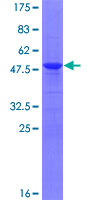 DCTN6 / Dynactin 6 Protein - 12.5% SDS-PAGE of human DCTN6 stained with Coomassie Blue
