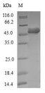 DCTN6 / Dynactin 6 Protein - (Tris-Glycine gel) Discontinuous SDS-PAGE (reduced) with 5% enrichment gel and 15% separation gel.