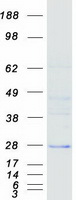 DCTN6 / Dynactin 6 Protein - Purified recombinant protein DCTN6 was analyzed by SDS-PAGE gel and Coomassie Blue Staining
