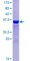 DCTPP1 / XTP3TPA Protein - 12.5% SDS-PAGE of human XTP3TPA stained with Coomassie Blue