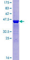 DCTPP1 / XTP3TPA Protein - 12.5% SDS-PAGE of human XTP3TPA stained with Coomassie Blue
