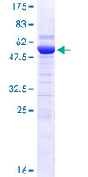 DCUN1D1 / SCCRO Protein - 12.5% SDS-PAGE of human DCUN1D1 stained with Coomassie Blue