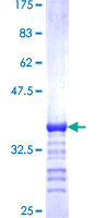 DCUN1D1 / SCCRO Protein - 12.5% SDS-PAGE Stained with Coomassie Blue.