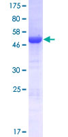 DCUN1D2 Protein - 12.5% SDS-PAGE of human DCUN1D2 stained with Coomassie Blue