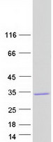 DCUN1D2 Protein - Purified recombinant protein DCUN1D2 was analyzed by SDS-PAGE gel and Coomassie Blue Staining