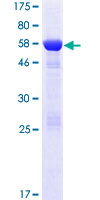 DCUN1D3 Protein - 12.5% SDS-PAGE of human DCUN1D3 stained with Coomassie Blue