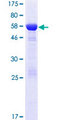 DCUN1D3 Protein - 12.5% SDS-PAGE of human DCUN1D3 stained with Coomassie Blue