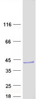 DCUN1D3 Protein - Purified recombinant protein DCUN1D3 was analyzed by SDS-PAGE gel and Coomassie Blue Staining
