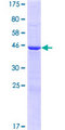 DCUN1D4 Protein - 12.5% SDS-PAGE of human DCUN1D4 stained with Coomassie Blue