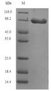 DCX / Doublecortin Protein - (Tris-Glycine gel) Discontinuous SDS-PAGE (reduced) with 5% enrichment gel and 15% separation gel.