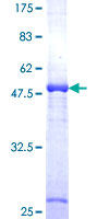 DCXR Protein - 12.5% SDS-PAGE of human DCXR stained with Coomassie Blue