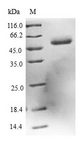 DCXR Protein - (Tris-Glycine gel) Discontinuous SDS-PAGE (reduced) with 5% enrichment gel and 15% separation gel.
