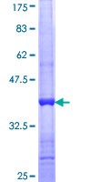 DCXR Protein - 12.5% SDS-PAGE Stained with Coomassie Blue.