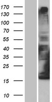 DCYTB / CYBRD1 Protein - Western validation with an anti-DDK antibody * L: Control HEK293 lysate R: Over-expression lysate