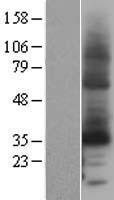 DCYTB / CYBRD1 Protein - Western validation with an anti-DDK antibody * L: Control HEK293 lysate R: Over-expression lysate
