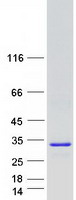 DCYTB / CYBRD1 Protein - Purified recombinant protein CYBRD1 was analyzed by SDS-PAGE gel and Coomassie Blue Staining