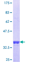 DDAH1 Protein - 12.5% SDS-PAGE Stained with Coomassie Blue.