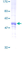 DDAH2 Protein - 12.5% SDS-PAGE of human DDAH2 stained with Coomassie Blue