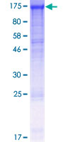 DDB1 Protein - 12.5% SDS-PAGE of human DDB1 stained with Coomassie Blue