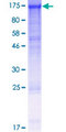 DDB1 Protein - 12.5% SDS-PAGE of human DDB1 stained with Coomassie Blue