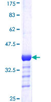 DDB1 Protein - 12.5% SDS-PAGE Stained with Coomassie Blue.