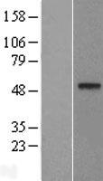 DDB2 Protein - Western validation with an anti-DDK antibody * L: Control HEK293 lysate R: Over-expression lysate