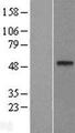 DDB2 Protein - Western validation with an anti-DDK antibody * L: Control HEK293 lysate R: Over-expression lysate