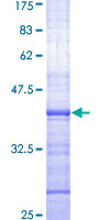 DDB2 Protein - 12.5% SDS-PAGE Stained with Coomassie Blue.