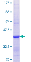 DDB2 Protein - 12.5% SDS-PAGE Stained with Coomassie Blue.