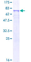 DDC / DOPA Decarboxylase Protein - 12.5% SDS-PAGE of human DDC stained with Coomassie Blue