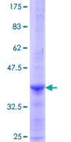 DDC / DOPA Decarboxylase Protein - 12.5% SDS-PAGE Stained with Coomassie Blue.